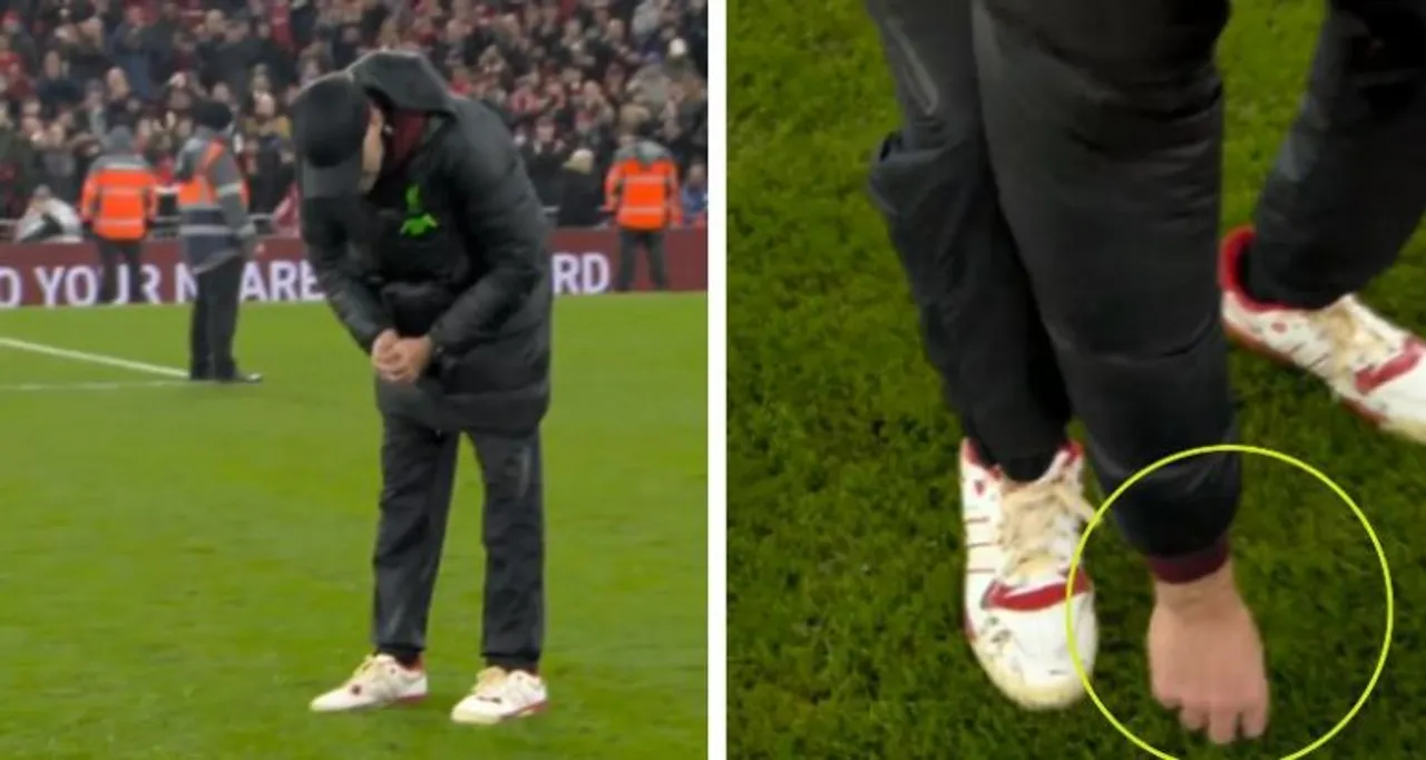 Pelatih Jurgen Klopp Kehilangan Cincin Kawin usai Bekuk Newcastle