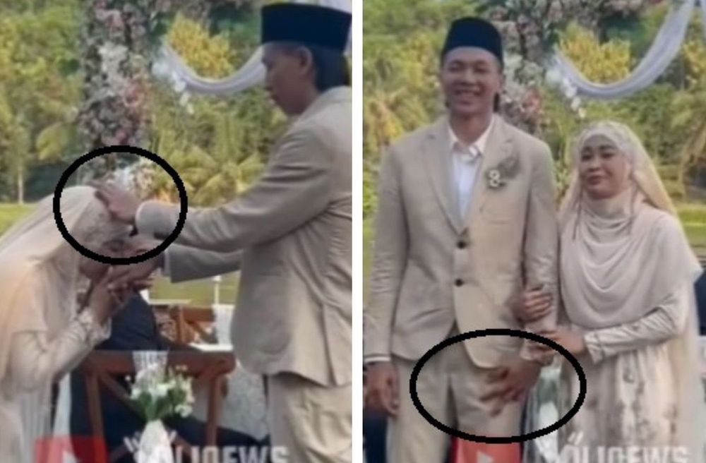 Cerita di Balik Jari Tangan Kiri Farhan Halim yang Cuma Tiga