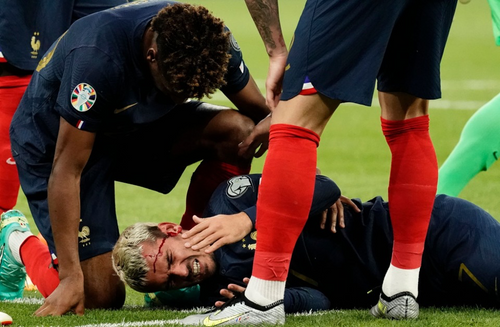 Antoine Griezmann Alami Cedera Kepala pada Laga Prancis vs Yunani